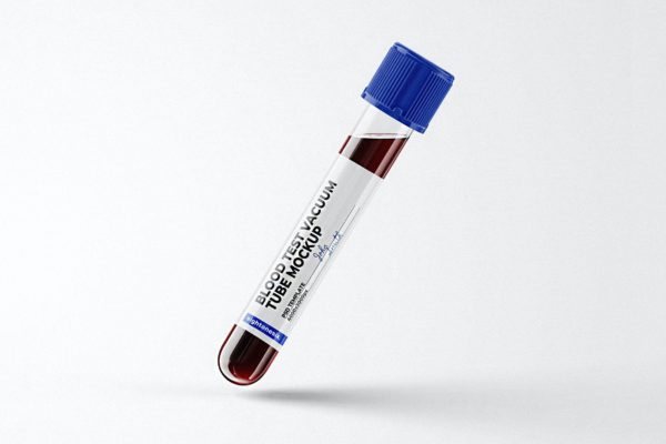 设计样机模板血液测试管 Blood Test Tube Mockup Template
